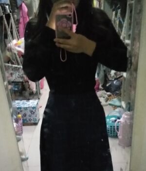 腰腹吸脂后腰線好看太多，肚子也小了