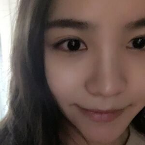 埋埋蛋白線.提升后臉上變得緊致許多，輪廓變得更好看