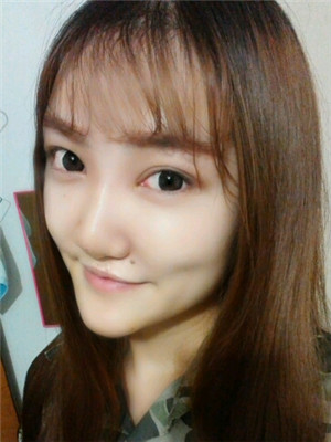 東方麗人陸忠凱做的注射瘦臉 臉變小了