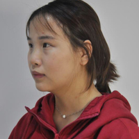 在蘇州常春藤做的硅膠假體隆鼻為大家分享下我的恢復全過程吧