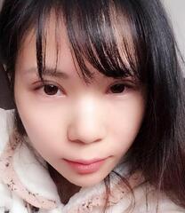 長沙美之峰重瞼+開眼角恢復(fù)過程圖