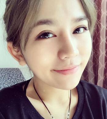 長沙美之峰假體隆鼻恢復(fù)日記