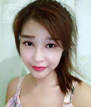 長沙美之峰隆鼻整形手術(shù)恢復(fù)日記圖