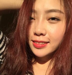 自體脂肪隆鼻、墊下巴、豐蘋果肌前后對比圖和恢復過程分享