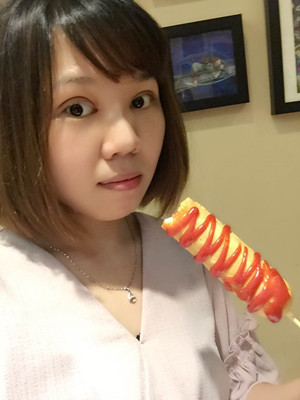 做了雙眼皮多項(xiàng)整形手術(shù)，大家來看看果如何