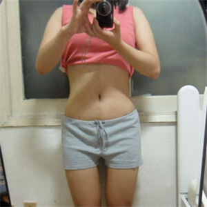 京韓做腰腹吸脂四個(gè)月的恢復(fù)照片，喬愛軍醫(yī)生的技術(shù)很好哦~