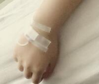 美白k氧注射針全身美白一個療程價格6800，確實變白了好些