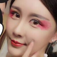 自體脂肪面部填充——豐太陽穴豐額頭恢復(fù)過程真實(shí)案例分享