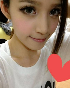 記錄了隆鼻三個月前后的恢復過程，希望可以幫到有需要的朋友