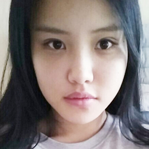 做下頜角整形手術(shù)半年了，給你們看看恢復(fù)過程照片吧~