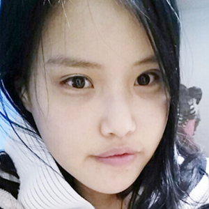 做下頜角整形手術(shù)半年了，給你們看看恢復(fù)過程照片吧~