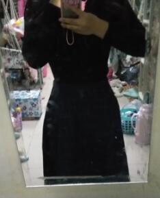 抽脂減肥瘦腰腹親身經(jīng)歷和前后對比圖案例分享