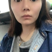 自體脂肪面部填充后年輕了好幾歲呢