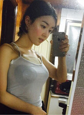 假體隆胸手術(shù)恢復(fù)過程分享，還有前后對比照片哦