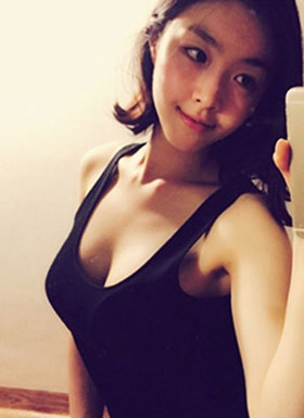 假體隆胸手術(shù)恢復(fù)過程分享，還有前后對比照片哦