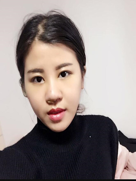 終于做里隆鼻整形手術(shù) 快來圍觀我時候果吧