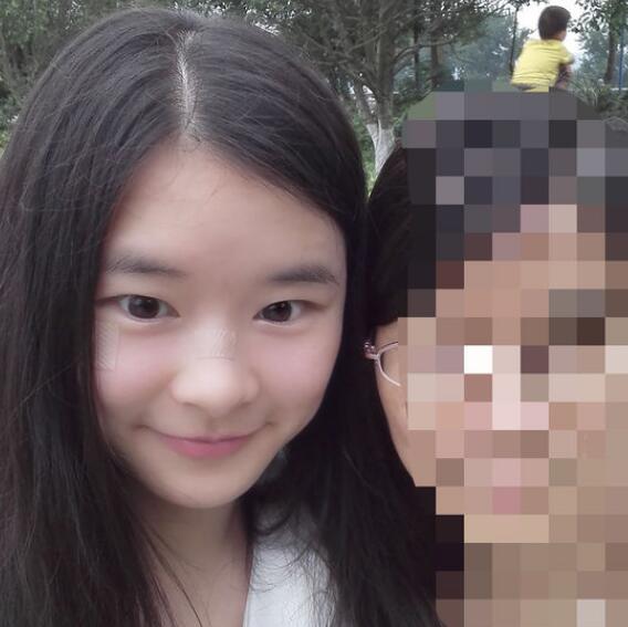 分享手術切除祛疤恢復過程希望對大家有幫助