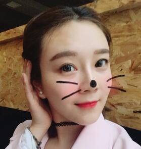 武漢中愛(ài)自體脂肪豐唇+面部填充恢復(fù)記錄