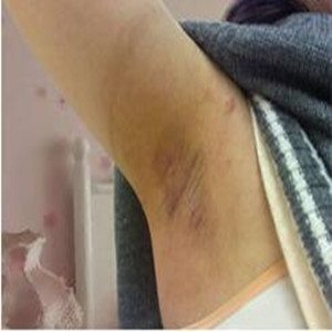 我自身去狐臭的真實(shí)經(jīng)歷 你不去試過怎么會知道果了