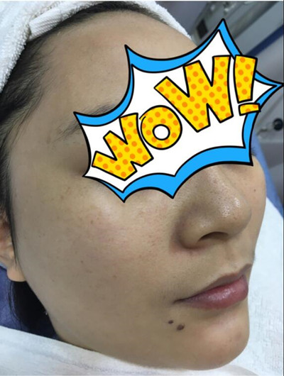 酷來圍觀我的水養(yǎng)嫩膚果怎么樣