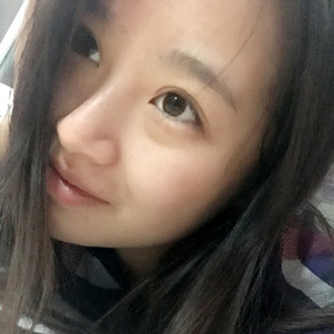 做了玻尿酸隆眉弓，感覺棒棒噠