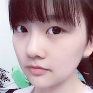 自體耳軟骨隆鼻之后就是女神范兒