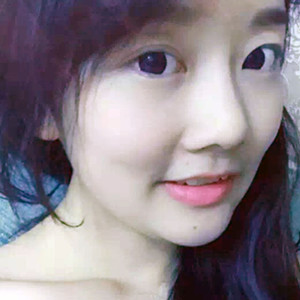 自體耳軟骨隆鼻之后就是女神范兒