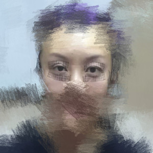 做了眼部電波l皮，一下子年輕了不少啊