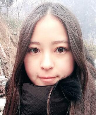 梨花雨割雙眼皮恢復(fù)半年了