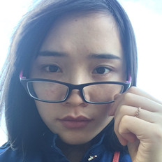 自體脂肪填充淚溝手術(shù)前后對比照片和恢復(fù)過程分享