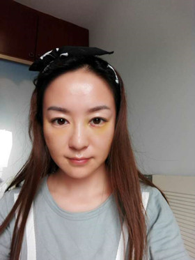 蛋白線面部埋埋蛋白線.提升，改良我的皮膚問題