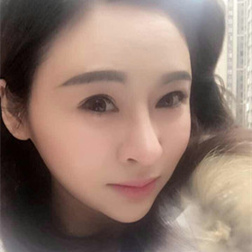 自體脂肪填充面部前后過程以及對比照片，真實案例分享