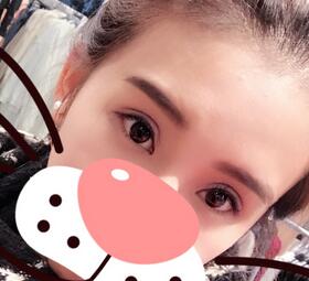 上海韓鏡割雙眼皮一個(gè)月