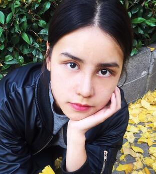 上海韓鏡網(wǎng)紅套餐半個(gè)月經(jīng)歷 雙眼皮多項(xiàng)整形+隆鼻整形+脂肪填充