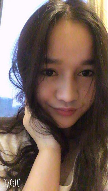 做了隆鼻整形手術(shù)整個(gè)鼻子靈巧了許多 快來(lái)圍觀果