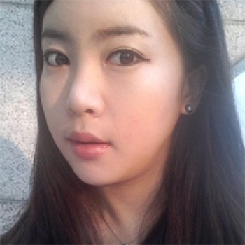 分享美立方做下頜角整形手術(shù)經(jīng)歷，還有前后對(duì)比果圖片哦~