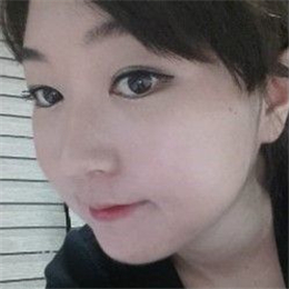 下頜角整形手術(shù)前后對(duì)比果圖片分享，還有恢復(fù)過(guò)程心路歷程~~~