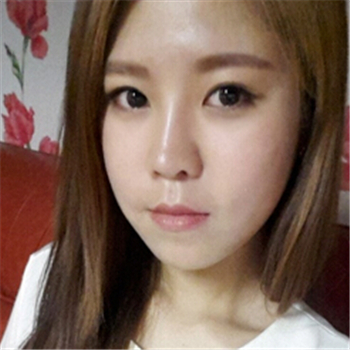 藝星做的玻尿酸去法令紋，分享恢復(fù)過程和前后對比照片~