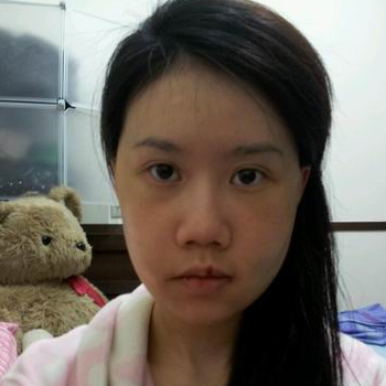 磨下頜角面部輪廓整形上個月，分享恢復(fù)過程和對比照片哦~