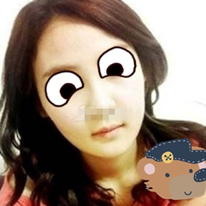 南相宰磨下頜角手術(shù)恢復(fù)過程分享，還有前后對比圖片哦~