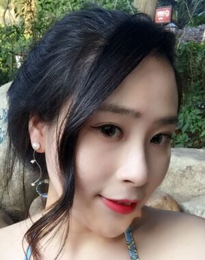 深圳美萊整形醫(yī)院做了進(jìn)口硅膠墊下巴臉型都變好看了