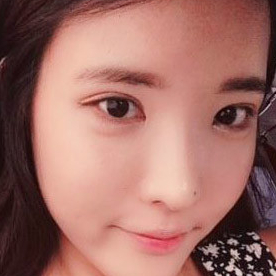 鷹鉤鼻矯正整形手術恢復過程和前后對比果圖片，分享給大家~