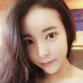 鷹鉤鼻矯正整形手術恢復過程和前后對比果圖片，分享給大家~