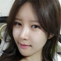 做了埋線雙眼皮、隆鼻、磨下頜角，兩個(gè)月了，分享恢復(fù)照片~