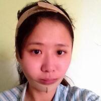 磨下頜角整形——恢復(fù)3個月后真實磨骨案例分享