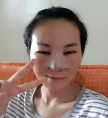 真人記錄了硅膠隆隆鼻整形手術前后過程，大家進來看看吧!