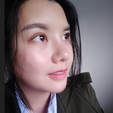 假體隆鼻兩個(gè)月后的感覺(jué) 隆鼻整形手術(shù)恢復(fù)日記