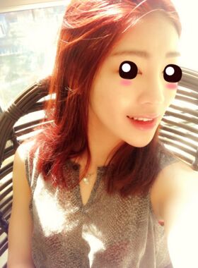 線D隆鼻恢復(fù)過(guò)程圖，看看我的果怎么樣