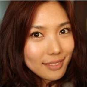 武漢希思特做了埋線法雙眼皮、開內(nèi)眼角和鼻尖移植軟骨整形手術(shù)~