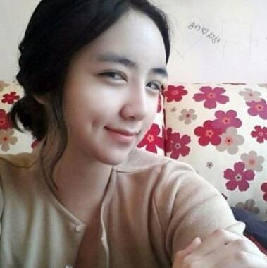 切開雙眼皮和硅膠假體隆鼻手術(shù)前后對比果圖片分享~